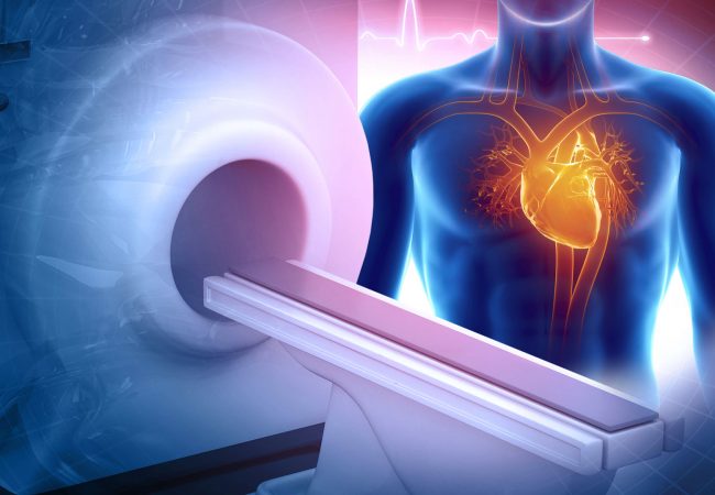 Cardiac Magnetic Resonance (CMR)