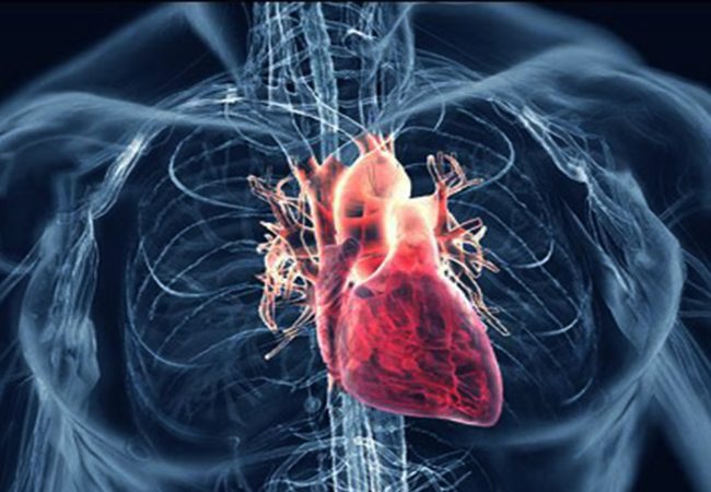 Cardiac MRI - CMR